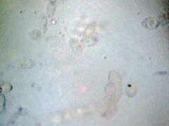 Dermatocarpon miniatum