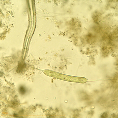 Centritractus belonophorus