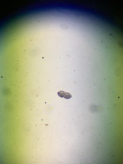 Protozoa