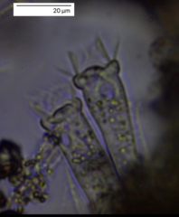 Vaginicolidae
