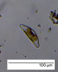Cymbella