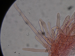 Melanoleuca grammopodia