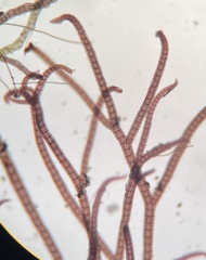 Vertebrata