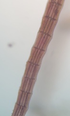 Vertebrata