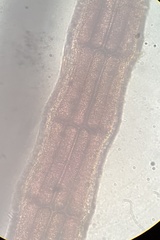 Vertebrata