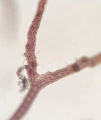 Vertebrata