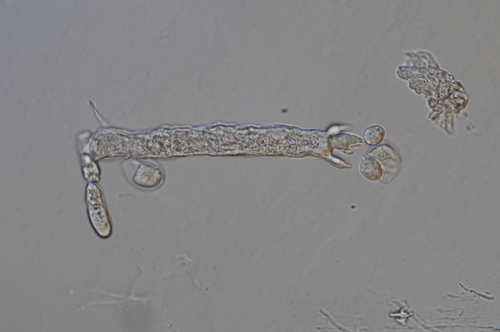 Sclerospora graminicola, 2014-03-28