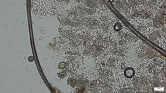 Rhizochaete radicata