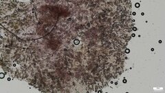 Rhizochaete radicata