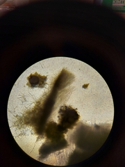 Aspergillus