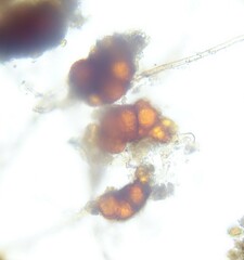 Dicranella staphylina