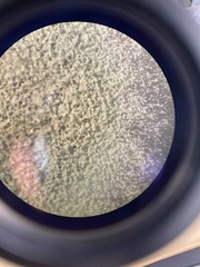 Aspergillus