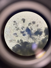 Aspergillus