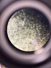 Aspergillus