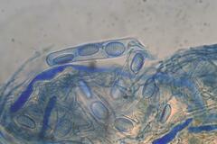 Plectania rhytidia