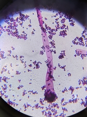 Aspergillus