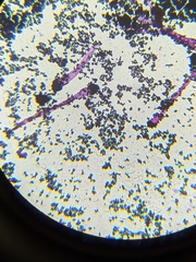 Aspergillus