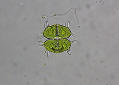 Xanthidium antilopaeum polymazum