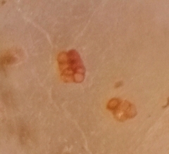 Pseudotrochamminita malcolmi