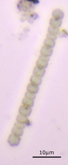 Anabaena