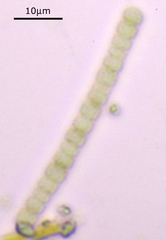 Anabaena