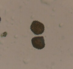 Fossombronia wondraczekii