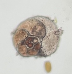 Foraminifera