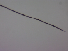 Dolichospermum