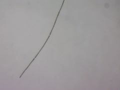 Dolichospermum