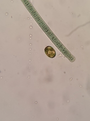 Protozoa