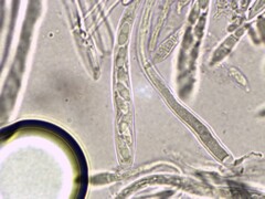 Ionomidotis irregularis