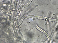 Agaricomycotina