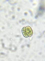 Cosmarium contractum