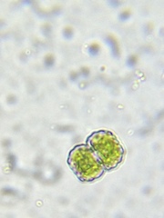 Cosmarium anisochondrum