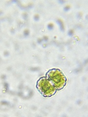 Cosmarium anisochondrum