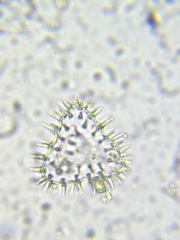 Staurastrum polytrichum