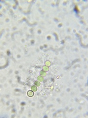 Dolichospermum
