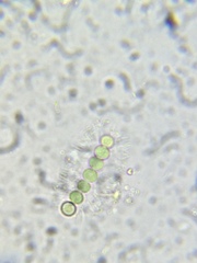 Dolichospermum