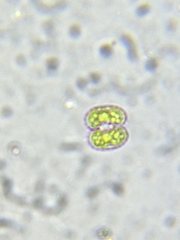 Cosmarium punctulatum