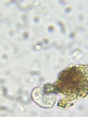 Hymenostomatia
