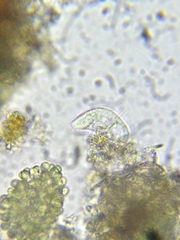 Paramecium