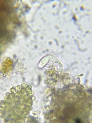 Paramecium