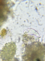 Paramecium