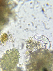 Paramecium