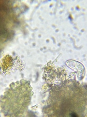 Paramecium