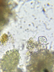 Paramecium