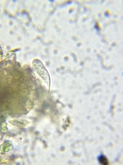 Paramecium
