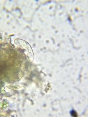 Paramecium