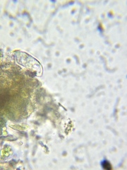 Paramecium