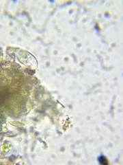 Paramecium